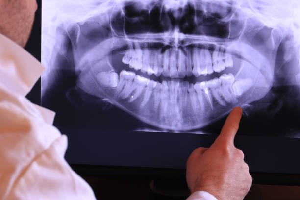 Best Urgent Dental Care for Toothaches in Orchards, WA